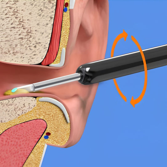 Wireless Ear Cleaner with Camera High Precision Ear Wax Removal Tool